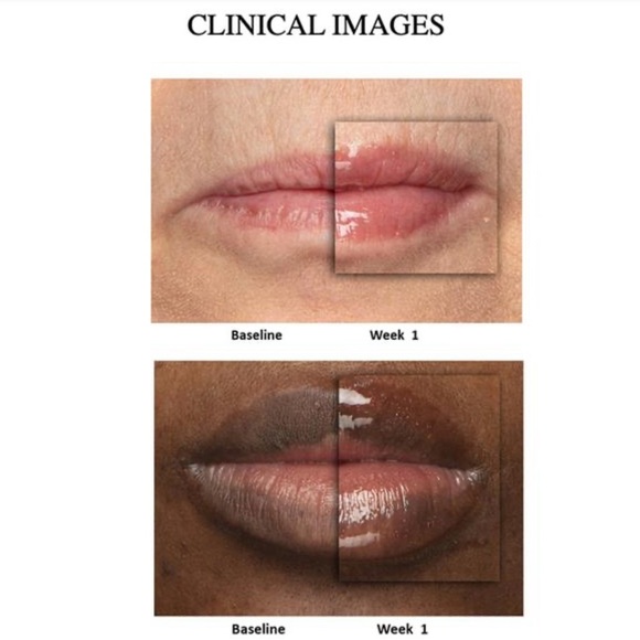 NU Colour Peptide Pout Lip Gloss - Picture 4 of 5